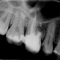 Chirurgia stomatologia Radom