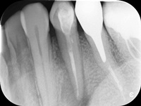 Endodoncja Radom ul. Zakręt 6