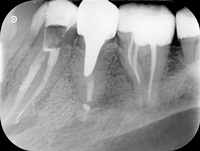 Endodoncja Radom ul. Zakręt 6