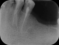 Endodoncja Radom ul. Zakręt 6