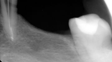Stomatologia mikroskopowa Stomatologia mikroskopowa Radom
