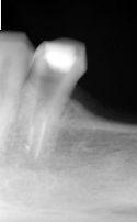 Stomatologia mikroskopowa Stomatologia mikroskopowa Radom