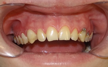 Stomatologia mikroskopowa Stomatologia mikroskopowa Radom
