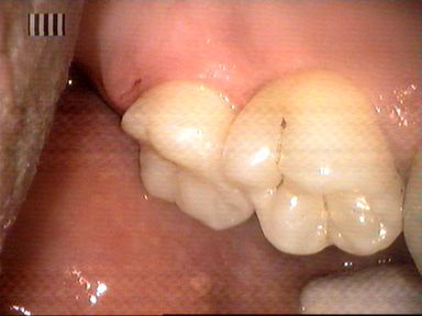 Stomatologia zachowawcza Radom